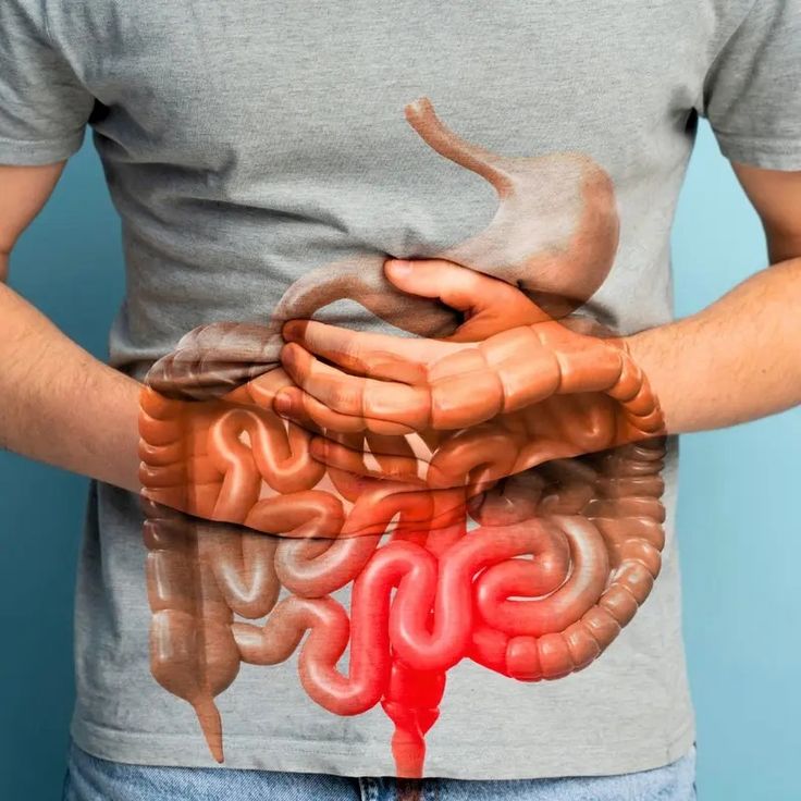 BRAVORA™ - GUT SUPPORT CAPSULE